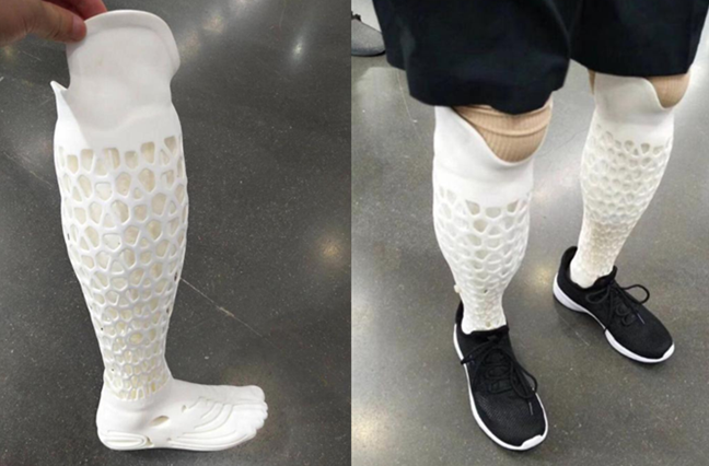 ขาเทียม